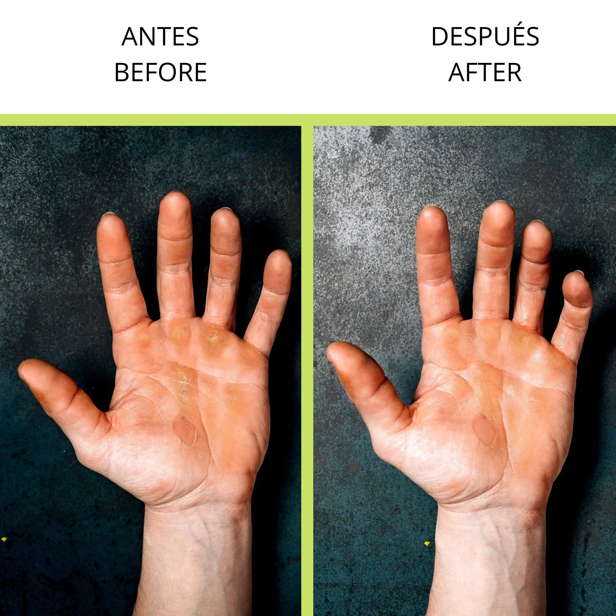 Velites hårdhuds fjerner